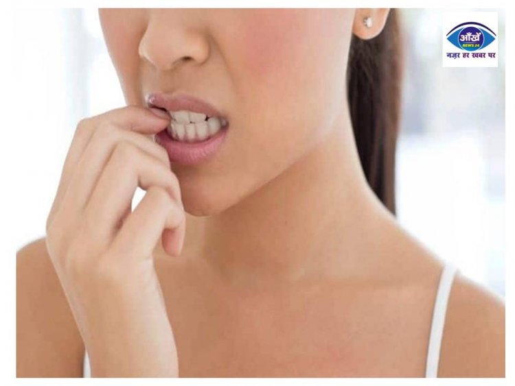 आपको भी नाखून चबाने की आदत है तुरंत छोड़ दें वरना मुंह से लेकर पेट तक की हो सकती हैं कई गंभीर समस्याएं