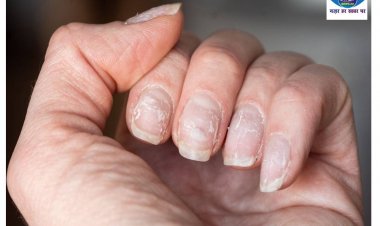 सेहत के बारे में आपके नाखून बताते हैं बहुत कुछ, जानें कैसी है आपकी हेल्थ