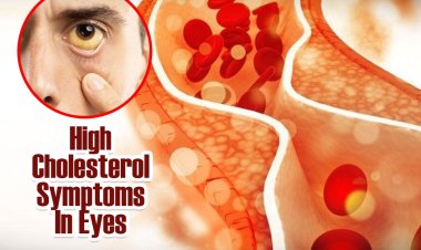 High Cholesterol  बढ़ने पर आंखों में दिखते हैं ये 3 लक्षण, नजरअंदाज करना पड़ जाएगा भारी...