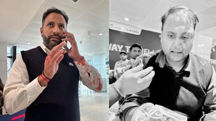 Delhi Airport Assault: एयर इंडिया एक्सप्रेस के पायलट पर यात्री से मारपीट का आरोप, सोशल मीडिया पर खून से सनी तस्वीरें वायरल